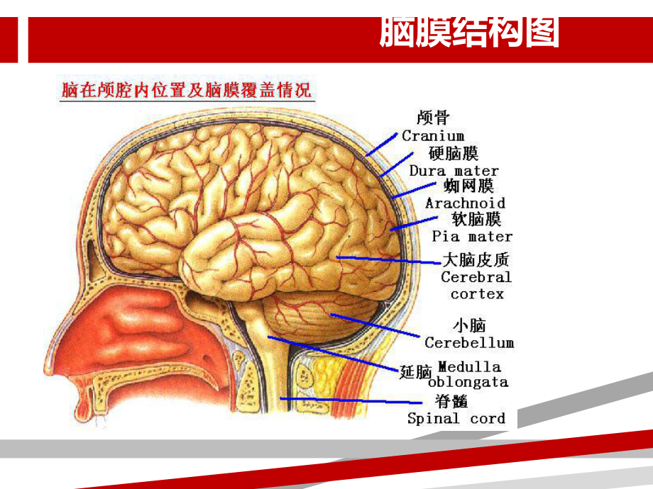 脑膜瘤的护理查房课件.ppt_第2页