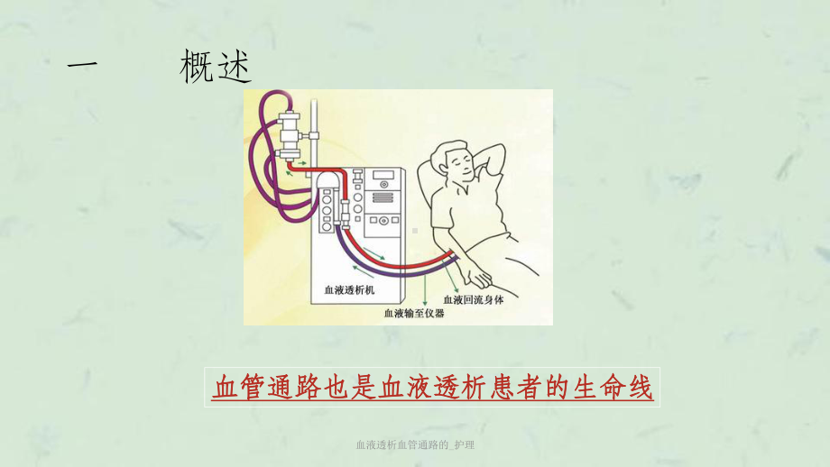 血液透析血管通路的-护理课件.ppt_第3页