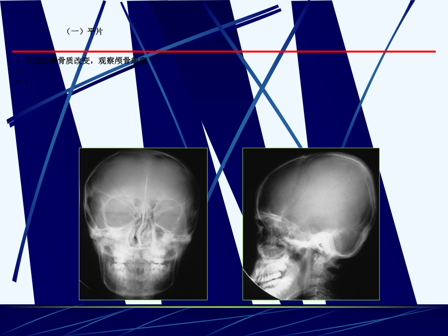 脑血管致病的影像诊断)课件.ppt_第2页