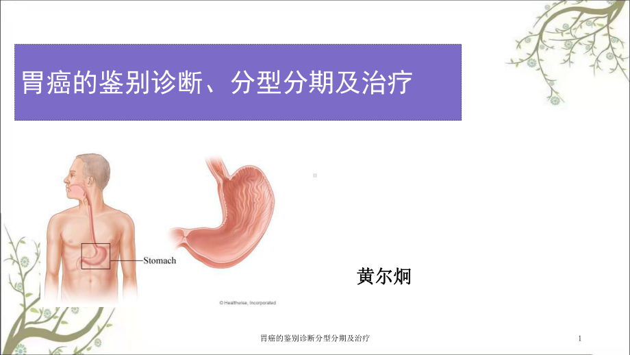 胃癌的鉴别诊断分型分期及治疗课件.ppt_第1页