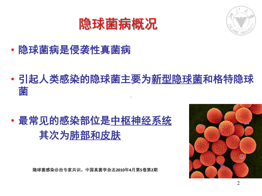 隐球菌病的诊断与治疗课件.ppt_第2页