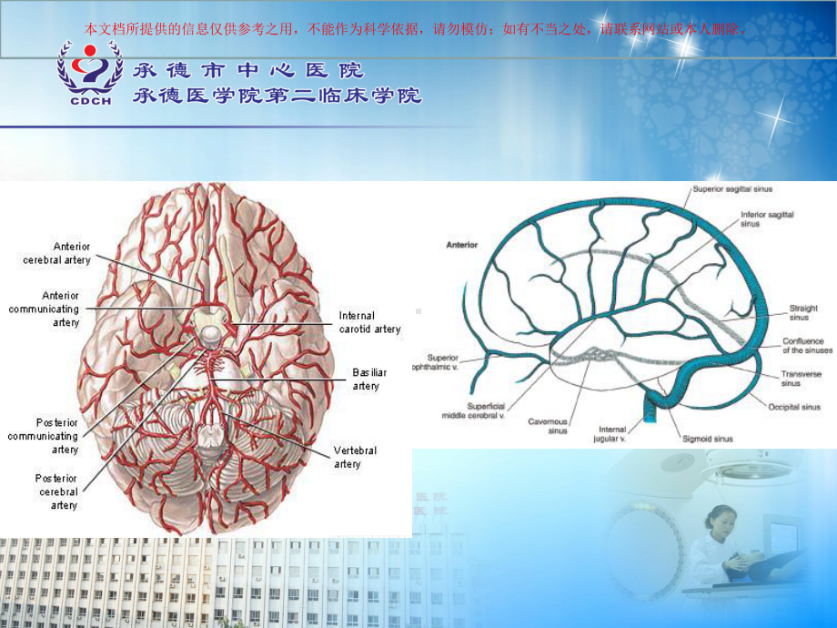 颅内动脉的分支与分段培训课件.ppt_第1页