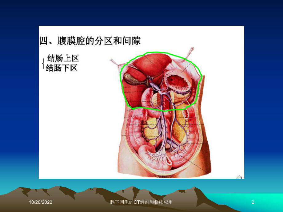 膈下间隙的CT解剖和临床应用培训课件.ppt_第2页