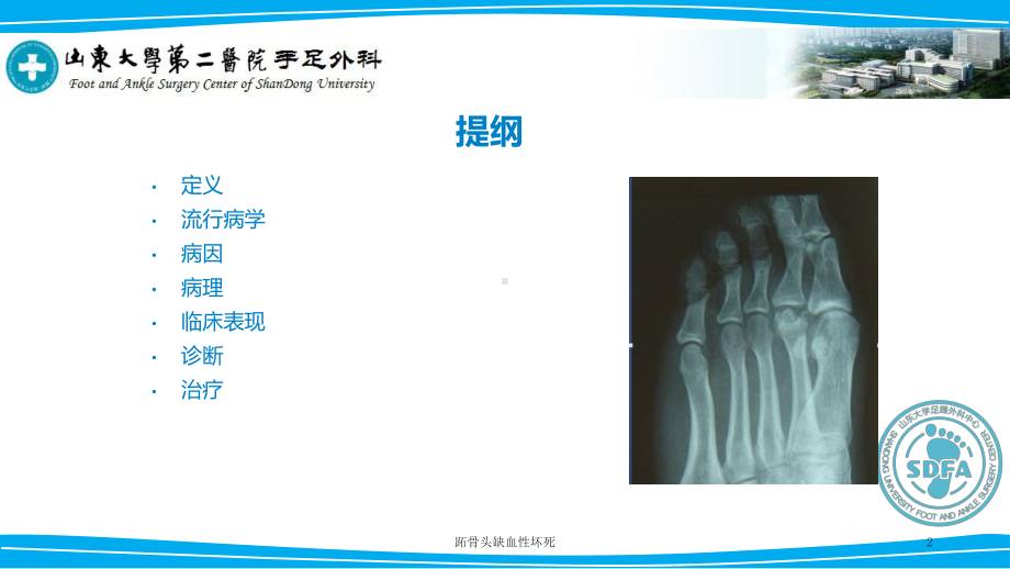 跖骨头缺血性坏死培训课件.ppt_第2页