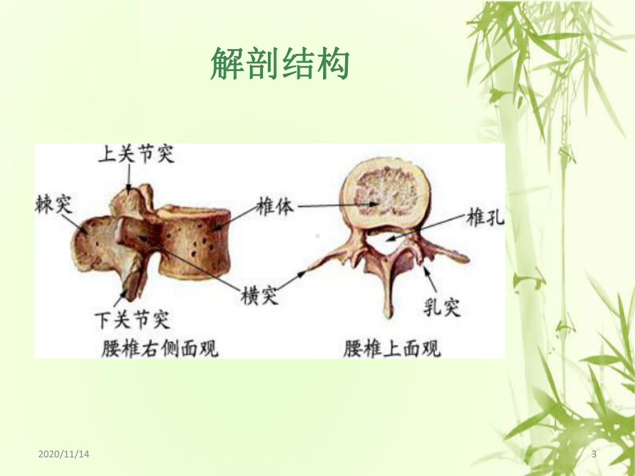 腰椎骨折护理课件.ppt_第3页