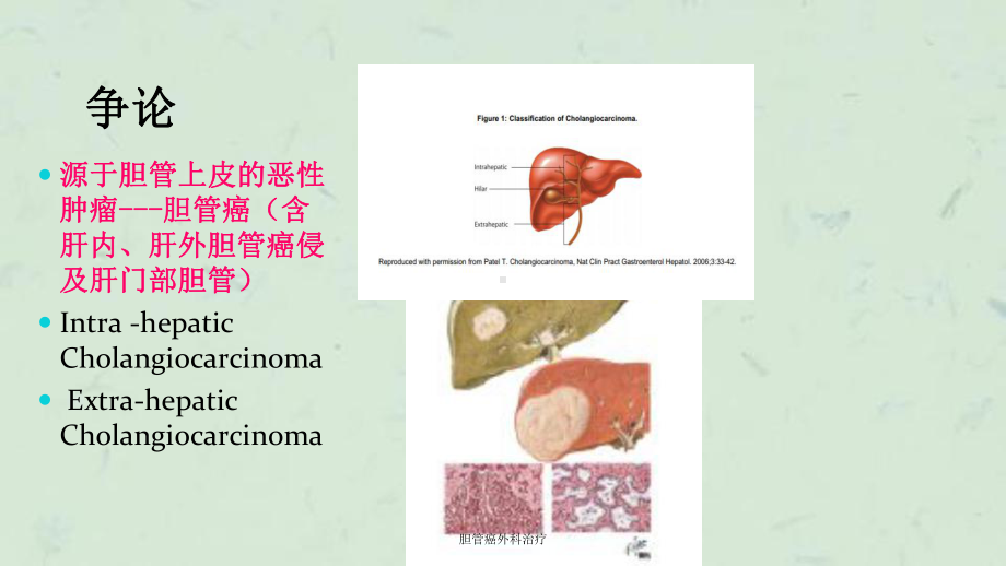 胆管癌外科治疗课件.ppt_第3页