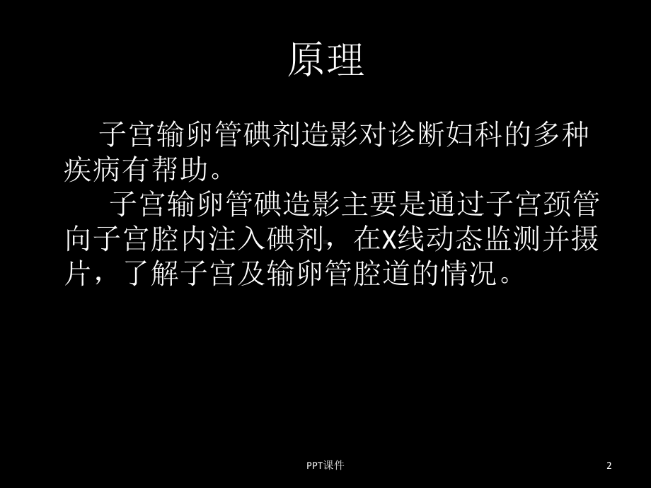 子宫输卵管造影及先天性发育异常-课件.ppt_第2页