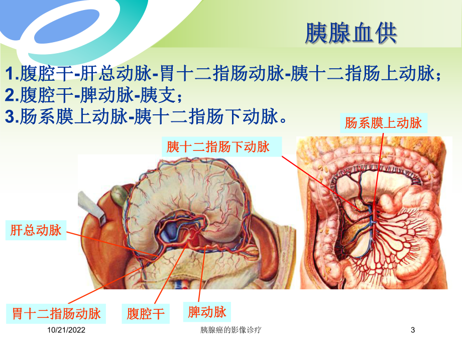 胰腺癌的影像诊疗培训课件.ppt_第3页