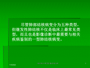 肺结核不典型影像表现分析培训课件.ppt