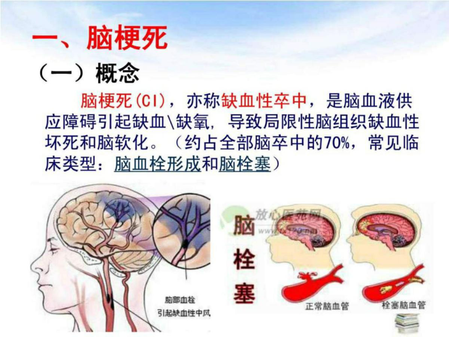 脑梗死病人的护理查房课件.pptx_第3页