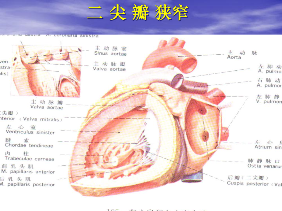 瓣膜置换术后监护课件.ppt_第3页