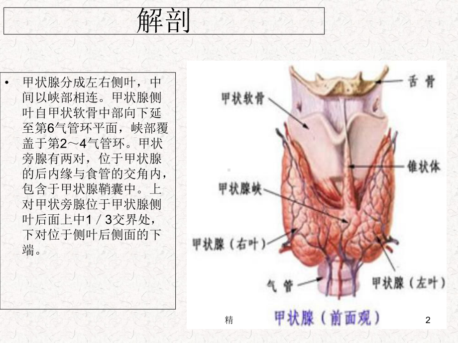 常见甲状腺疾病的CT诊断总结课件.ppt_第2页