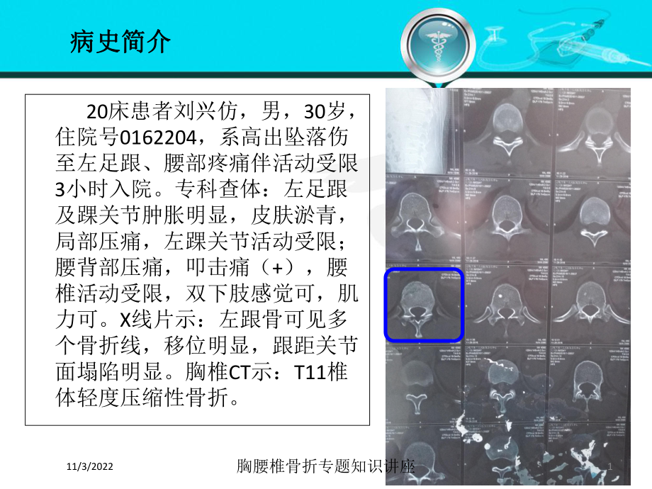 胸腰椎骨折专题知识讲座培训课件.ppt_第1页