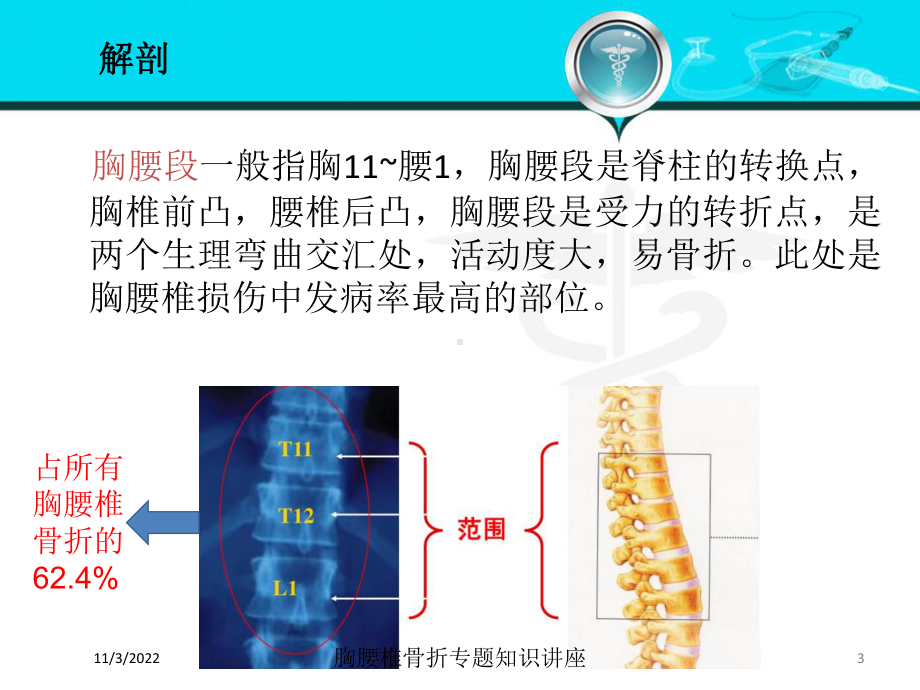 胸腰椎骨折专题知识讲座培训课件.ppt_第3页