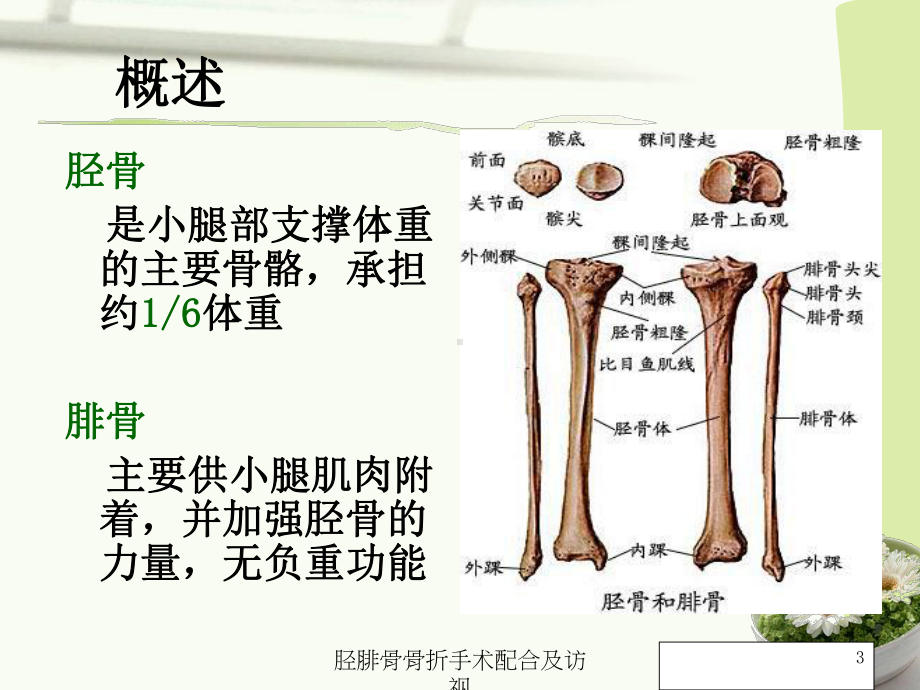 胫腓骨骨折手术配合及访视培训课件.ppt_第3页