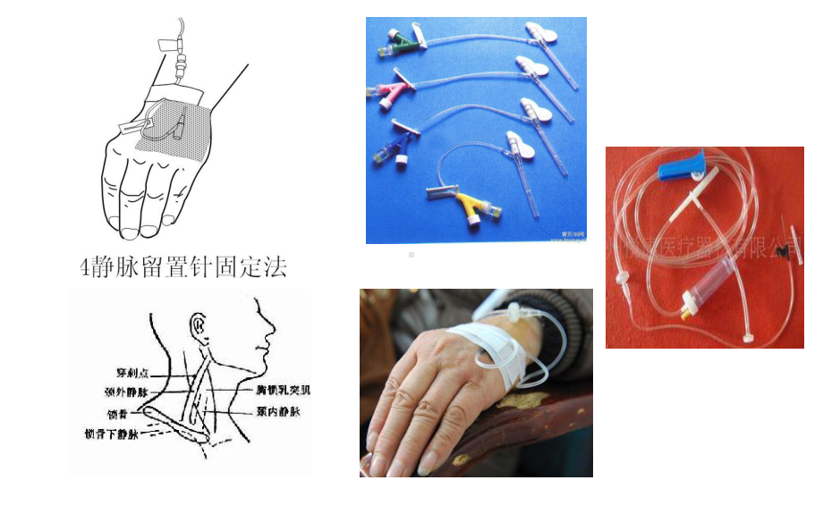 门诊输液观察与护理修改课件.ppt_第2页