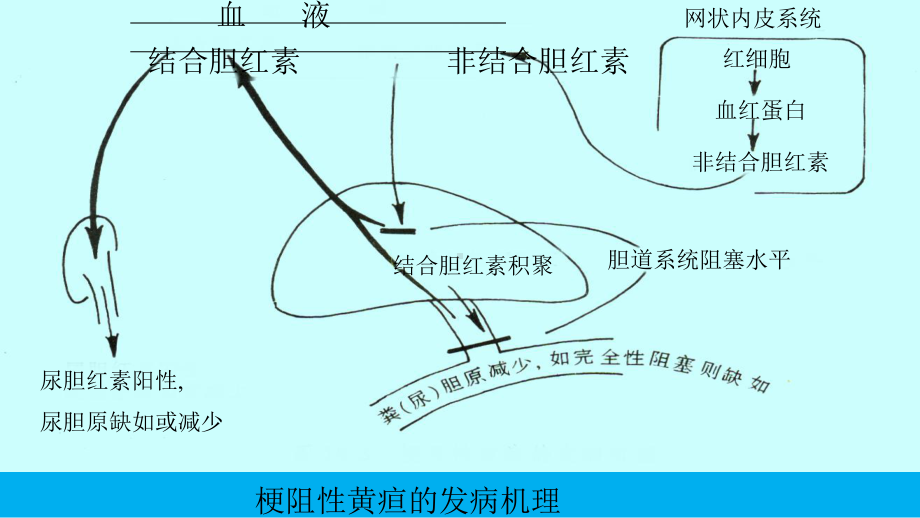 胆汁淤积性疾病病理研究进展及防治课件.pptx_第3页