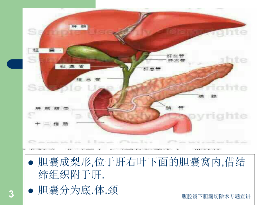 腹腔镜下胆囊切除术专题宣讲培训课件.ppt_第3页