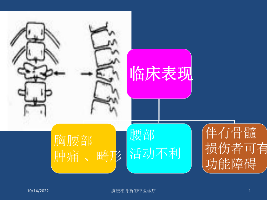 胸腰椎骨折的中医诊疗培训课件.ppt_第1页