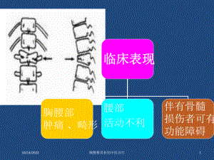 胸腰椎骨折的中医诊疗培训课件.ppt