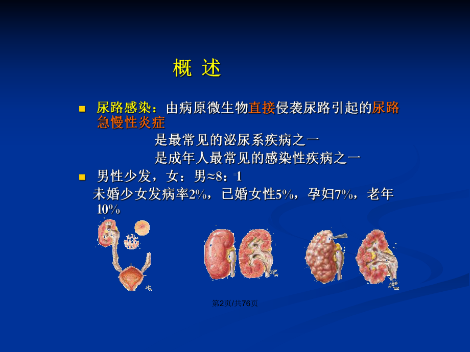 临床医学尿路感染病人的护理学习教案课件.pptx_第3页