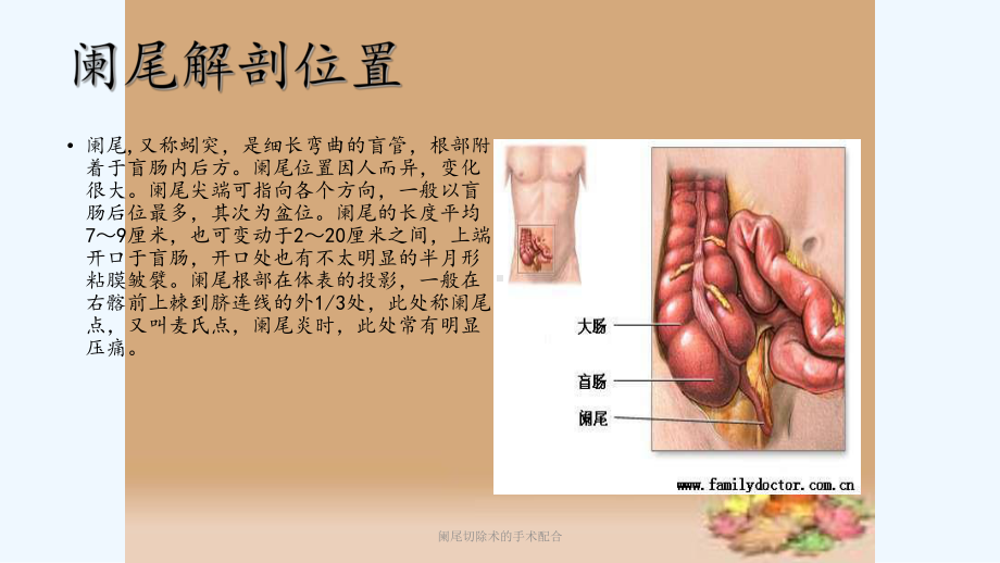 阑尾切除术的手术配合课件.pptx_第1页