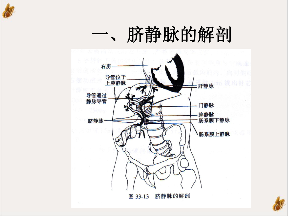 静脉插管技术在儿科重症新课件-2.ppt_第2页