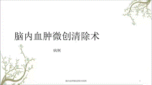 脑内血肿微创清除术病例课件.ppt