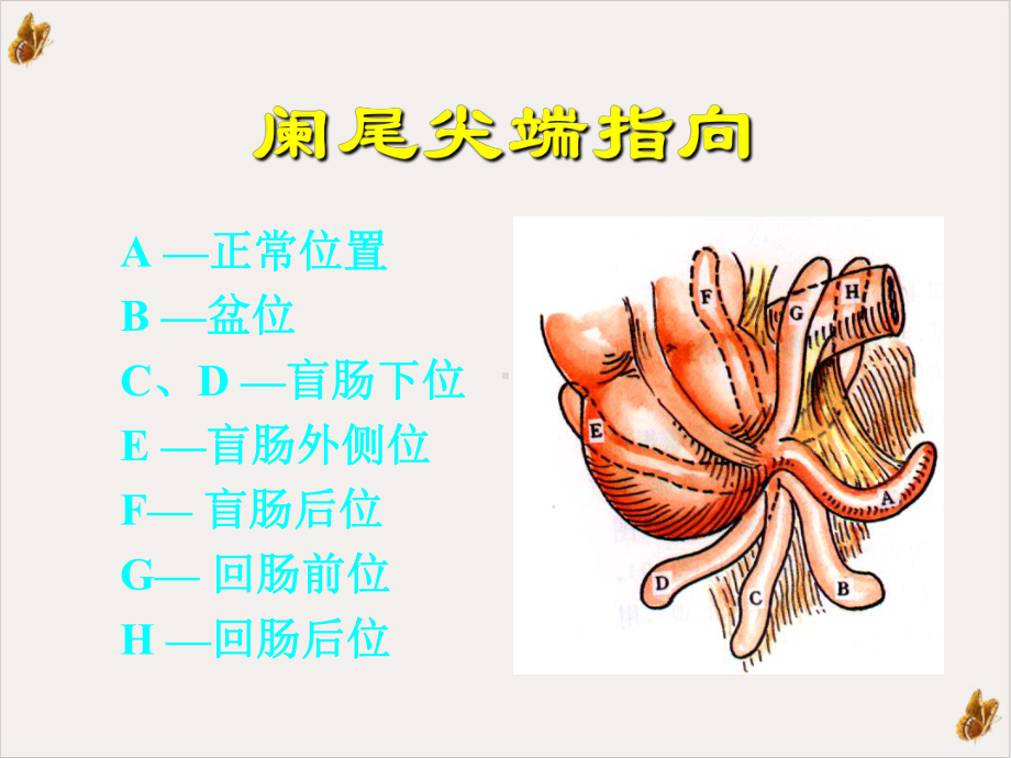 阑尾炎全套课件(模板).pptx_第3页