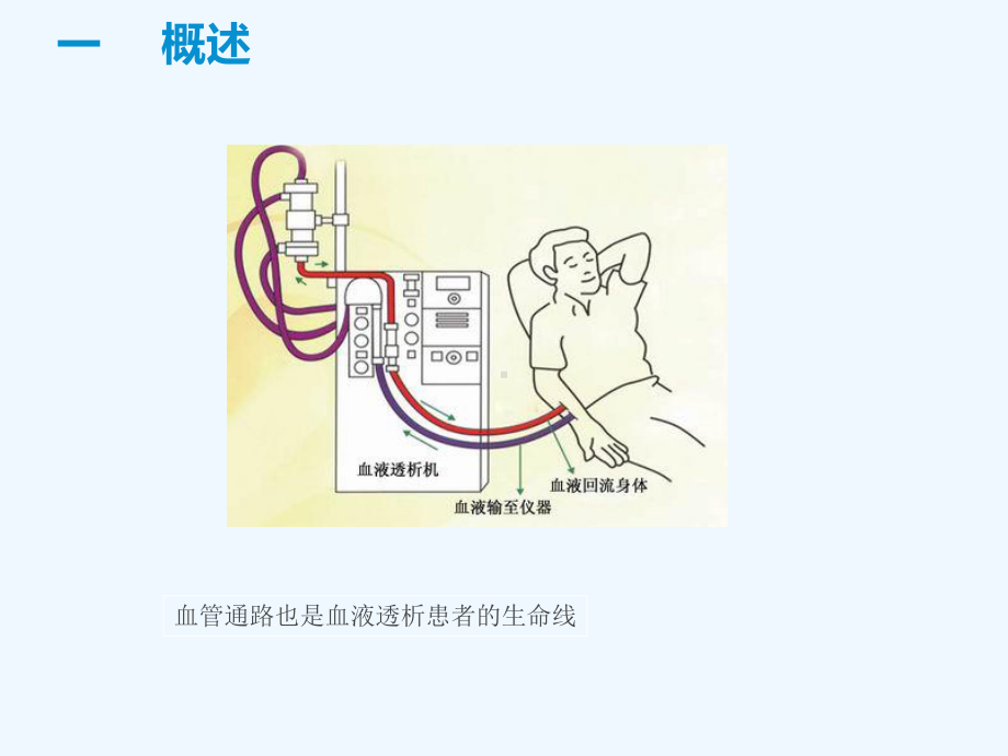 血液透析血管通路的护理课件.ppt_第3页