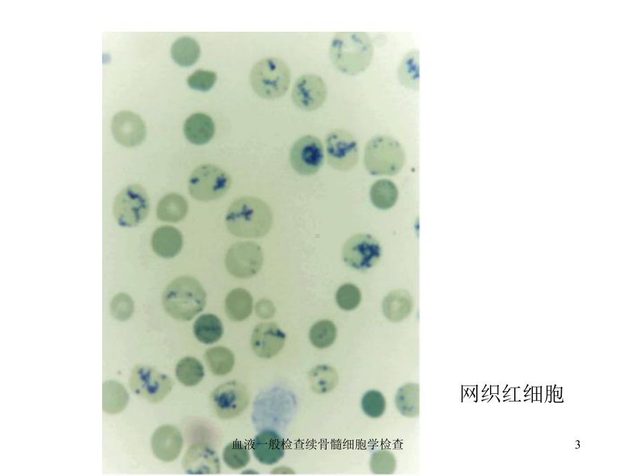 血液一般检查续骨髓细胞学检查培训课件.ppt_第3页