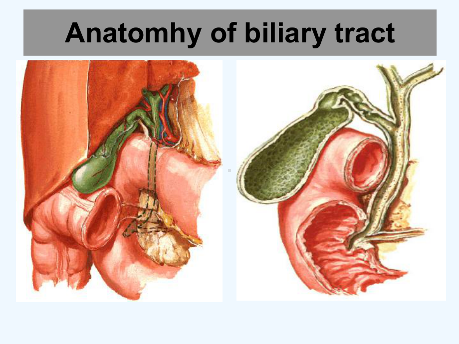 胆道疾病上海交大瑞金英课件.ppt_第3页