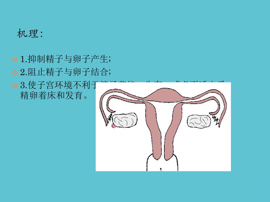 避孕药以外的避孕方式课件.ppt_第2页