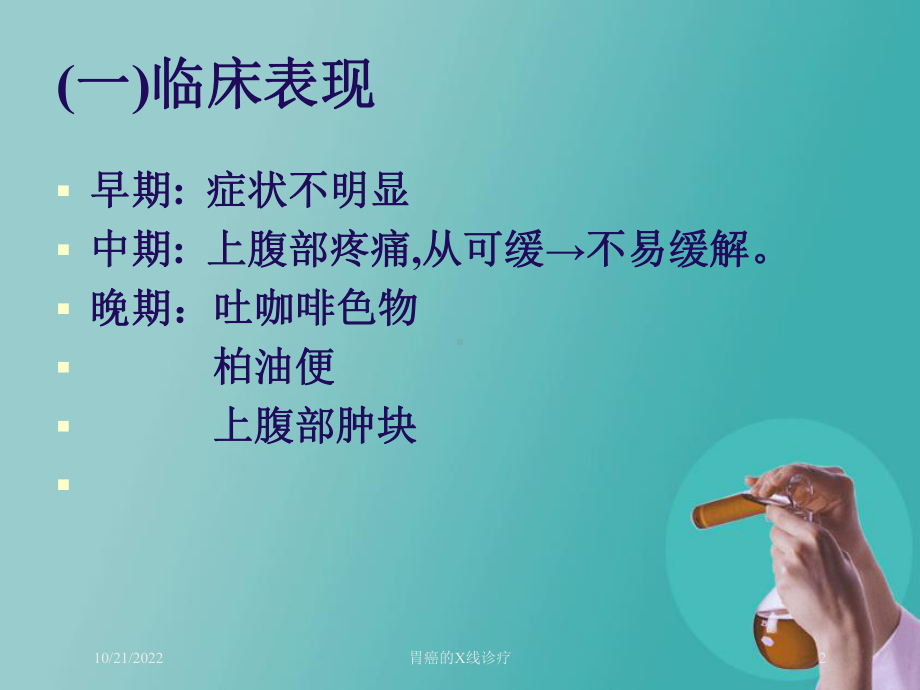 胃癌的X线诊疗培训课件.ppt_第2页