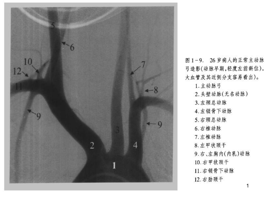 血管造影系列教学课件.ppt_第1页