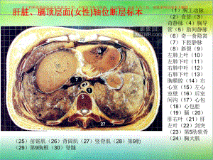 腹部断层解剖和断层CT培训课件.ppt