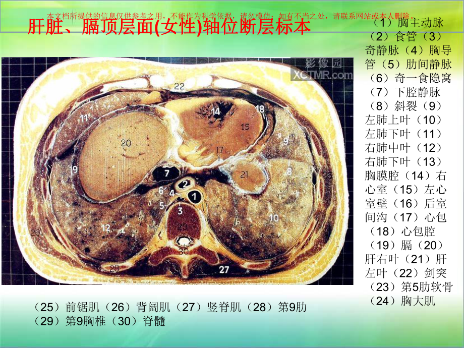 腹部断层解剖和断层CT培训课件.ppt_第1页