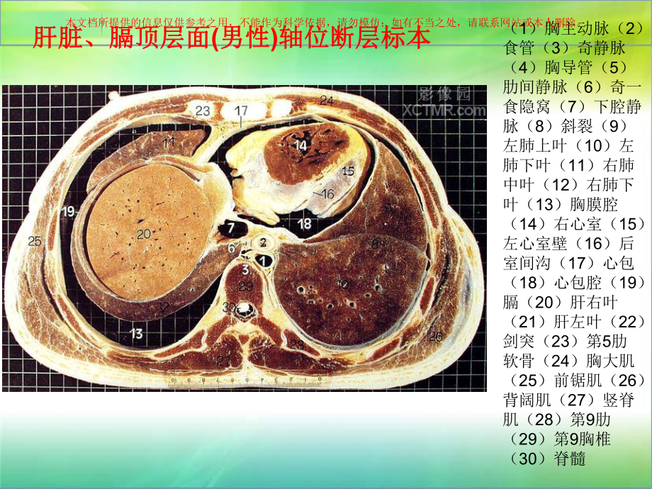 腹部断层解剖和断层CT培训课件.ppt_第2页