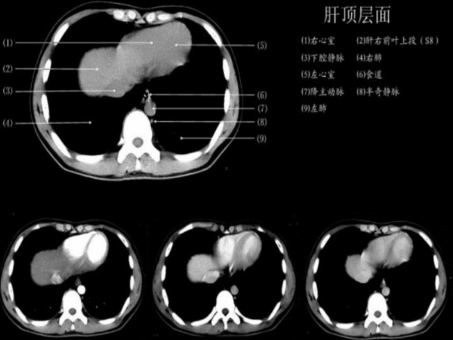 腹部断层解剖和断层CT培训课件.ppt_第3页