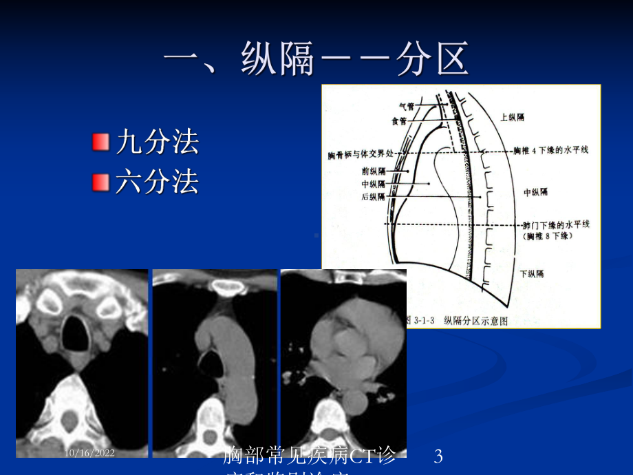 胸部常见疾病CT诊疗和鉴别诊疗培训课件.ppt_第3页