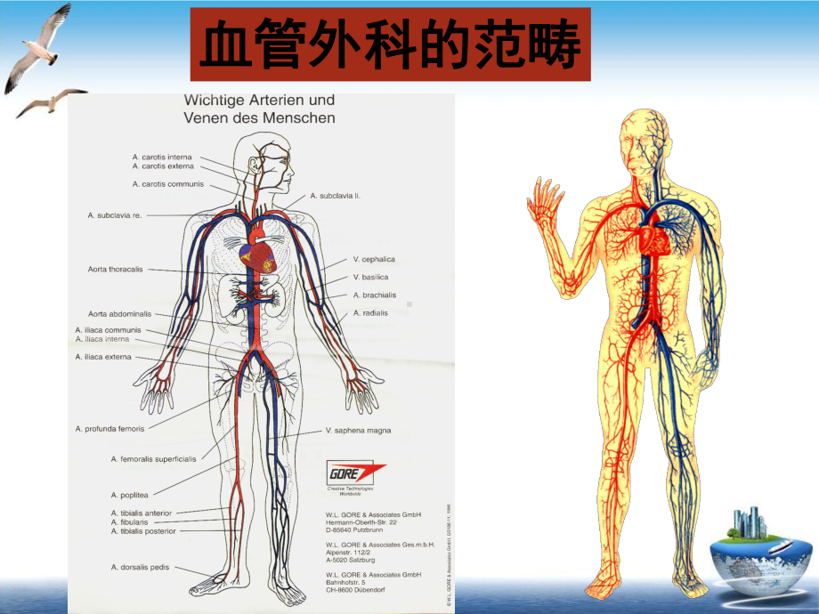 血管外科疾病示范课件.ppt_第3页