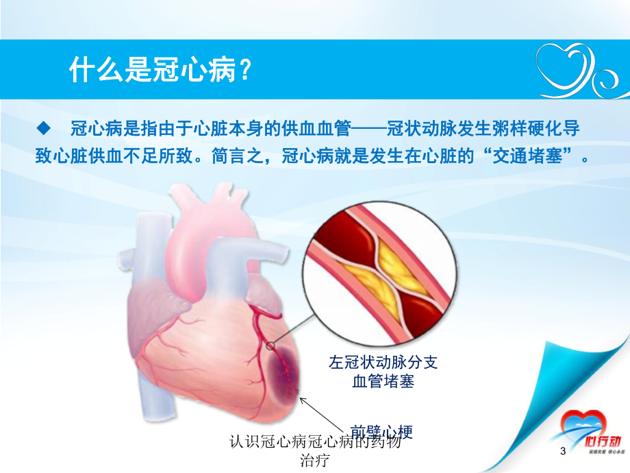 认识冠心病冠心病的药物治疗培训课件.ppt_第3页