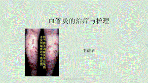 血管炎患者的治疗与护理课件.ppt