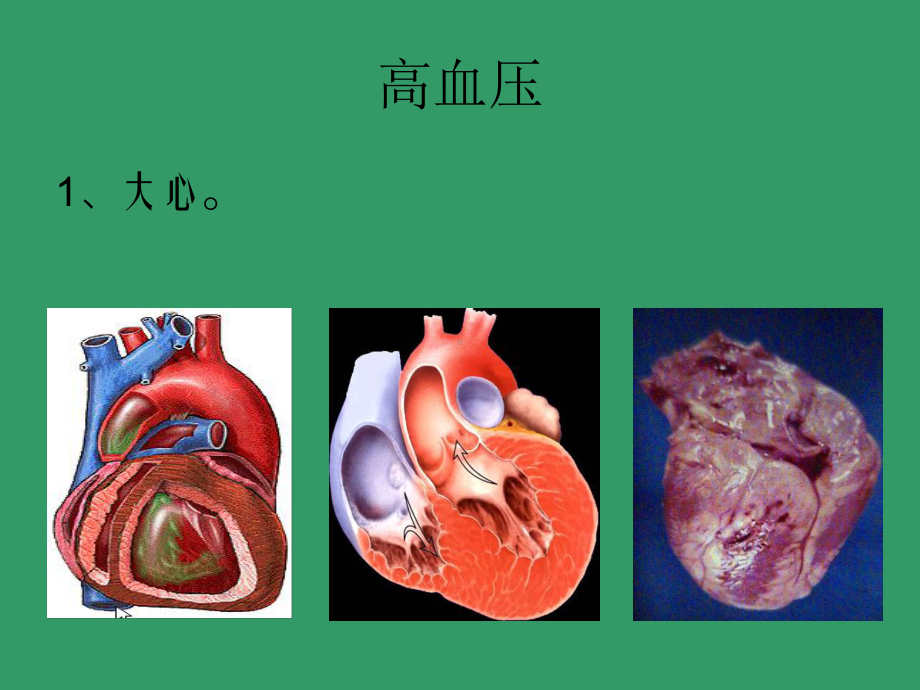 微循环和疾病课件.ppt_第3页