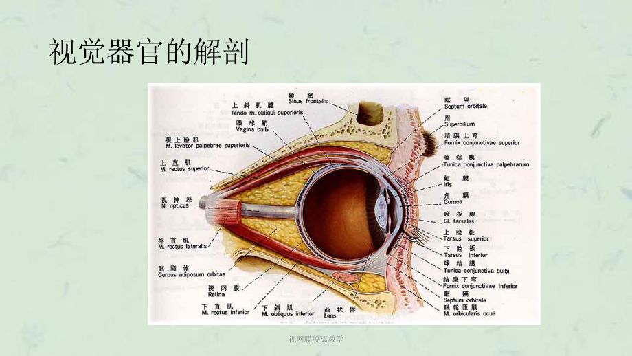 视网膜脱离教学课件.ppt_第3页