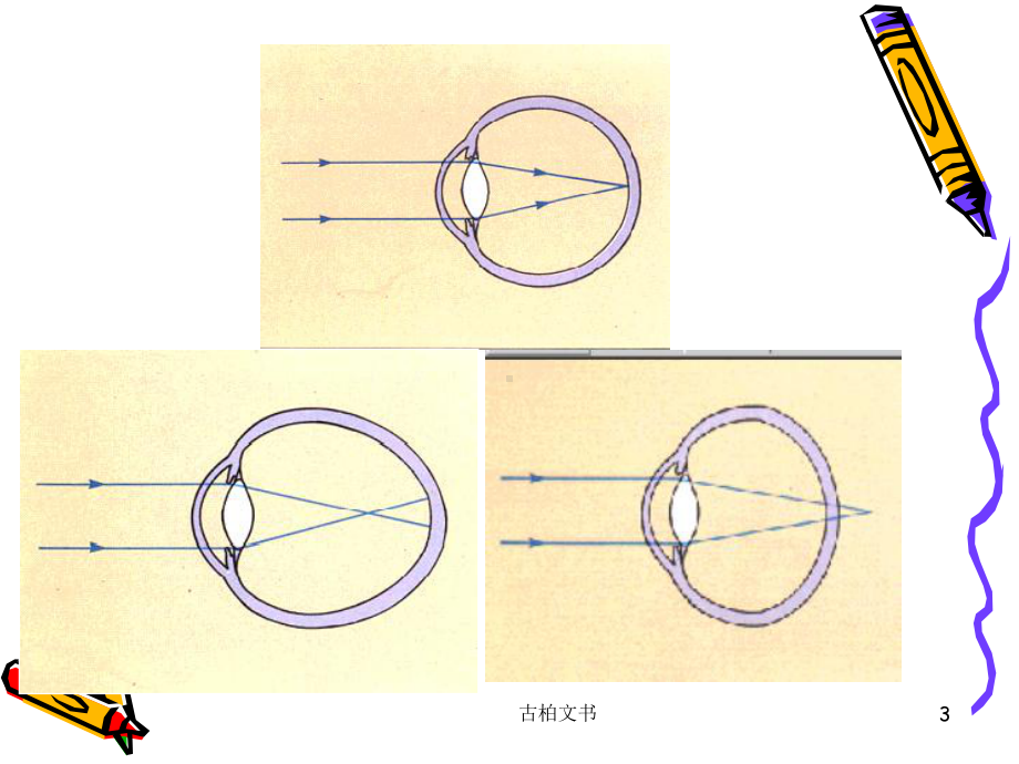 近视的预防课件(高级教育).ppt_第3页