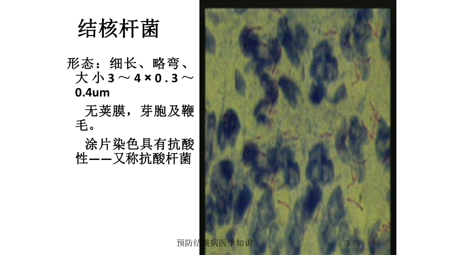 预防结核病医学知识培训课件.ppt_第3页