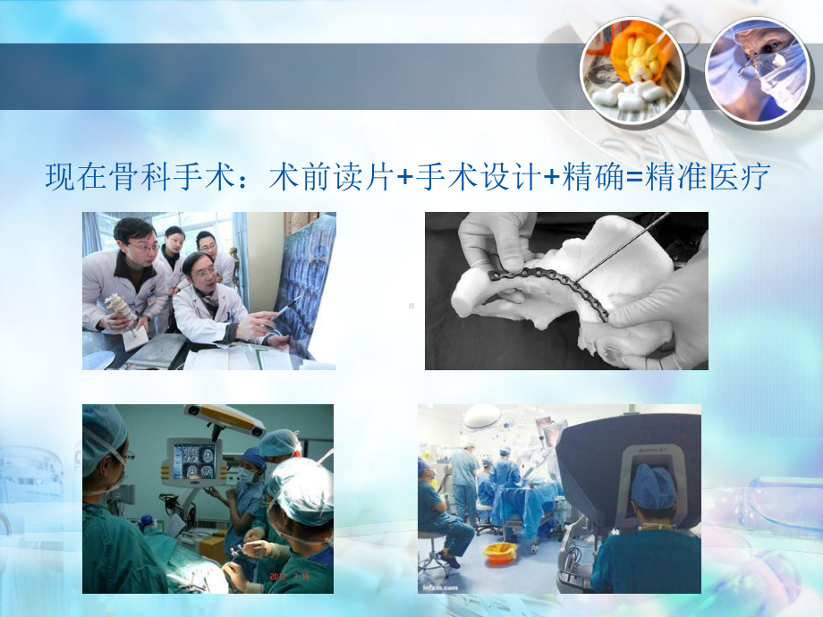 计算机辅助导航技术在骨科中应用课件.ppt_第3页