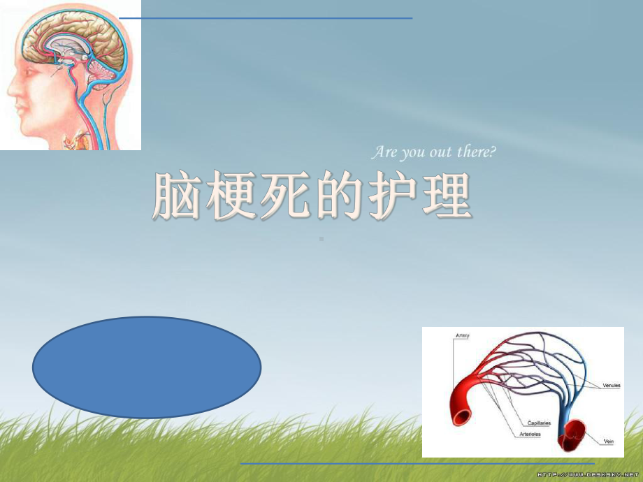 脑梗死护理内容课件.ppt_第1页