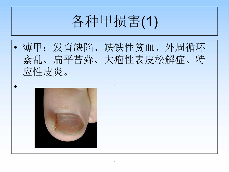 甲疾病医学课件.ppt_第3页